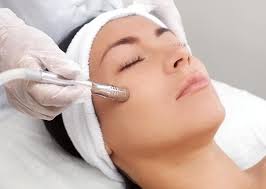 Peeling de Diamante